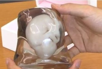 3D打印子宫或将问世 不用怀孕就能生孩子